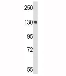Western blot analysis of CP antibody and mouse lung tissue lysate. Predicted molecular weight ~130 kDa.