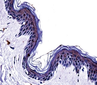 Tyrosinase antibody immunohsitochemistry analysis in formalin fixed and paraffin embedded human skin tissue.