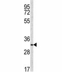 Western blot analysis of NQO1 antibody and NCI-H460 lysate. Predicted molecular weight ~30kDa.