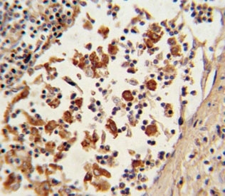 IHC analysis of FFPE human lymph tissue with BCL6 antibody