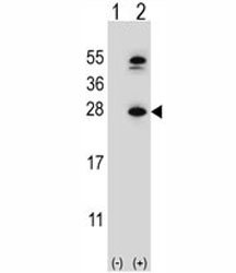 Western blot analysis of DHFR antibody and 293 cell lysate either nontransfected (Lane 1) or transiently transfected (2) with the DHFR gene. Predicted molecular weight ~22 kDa.