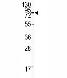 Western blot analysis of CD31 antibody and HL-60 lysate.