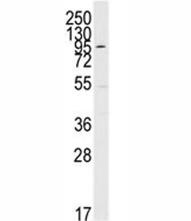 Western blot analysis of ERK5 antibody and K562 lysate
