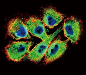 Confocal immunofluorescent analysis of EphB2 antibody with A375 cells followed by Alexa Fluor 488-conjugated goat anti-rabbit lgG (green). Actin filaments have been labeled with Alexa Fluor 555 Phalloidin (red). DAPI was used as a nuclear counterstain (blue).