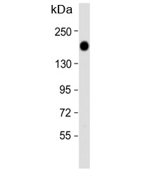 Western blot analysis of Epidermal growth factor receptor antibody and HeLa lysate. Expected molecular weight: ~134/170 kDa (unmodified/glycosylated).