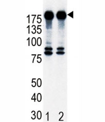 Western blot analysis of ErbB2 in T47D cell lysate, either noninduced (Lane 1) or induced with HRG (2).