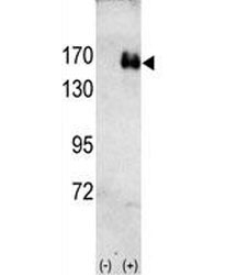 Western blot analysis of HER2 antibody and 293 cell lysate (2 ug/lane) either nontransfected (Lane 1) or transiently transfected with the ErbB2 gene (2).