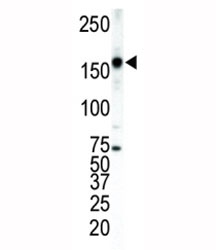 Western blot analysis of ERBB4 antibody and T47D cell lysate. Predicted molecular weight: 147-180 kDa (precursor), 120, 80 kDa (cleaved forms).