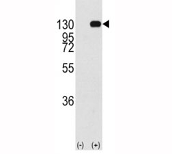 Western blot analysis of FGFR antibody and 293 cell lysate (2 ug/lane) either nontransfected (Lane 1) or transiently transfected with the FGFR1 gene (2). Predicted molecular weight: 75-160 kDa depending on glycosylation level.