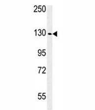 Western blot analysis of IGF1R antibody and WiDr lysate. Predicted molecular weight: ~200 kDa (pro), 120-130 kDa (alpha), 90-97 kDa (beta).