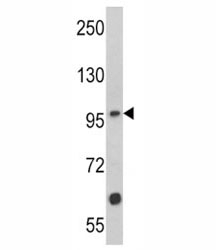 Western blot analysis of MUSK antibody and Jurkat lysate