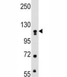 Western blot analysis of MUSK antibody and mouse kidney tissue lysate.