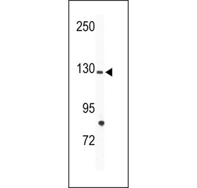 Western blot analysis of TIE1 antibody and mouse bladder tissue lysate.