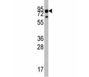 Western blot analysis of TrkA antibody and mouse liver tissue lysate. Observed molecular weight: 85~140 kDa depending on glycosylation level.