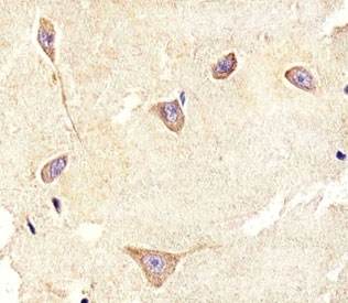 IHC analysis of FFPE human brain section using TrkC antibody; Ab was diluted at 1:100.