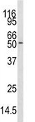 Western blot analysis of CAMKK antibody and mouse cerebellum tissue lysate. Predicted molecular weight 55-60 kDa.