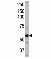 Western blot of ALK1 antibody and mouse heart tissue lysate. Predicted molecular weight ~60 kDa.