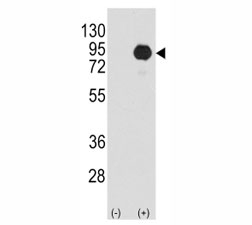 Western blot analysis of BRAF antibody and 293 cell lysate (2 ug/lane) either nontransfected (Lane 1) or transiently transfected with the B-RAF gene (2). Predicted size 85-95 kDa