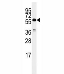 Western blot analysis of CDC25C antibody and K562 lysate. Expected molecular weight: ~53/60 kDa (unmodified/phosphorylated).