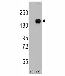 Western blot analysis of ASK1 antibody and 293 cell lysate (2 ug/lane) either nontransfected (Lane 1) or transiently transfected with the MAP3K5 gene (2).