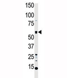 Western blot analysis of MST1 antibody and HL-60 cell lysate. Predicted molecular weight ~ 56 kDa.