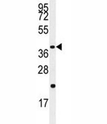 Western blot analysis of Caspase-9 antibody and Jurkat lysate