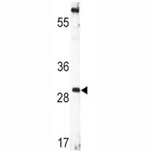 Western blot analysis of BDNF antibody and human CEM lysate. Predicted molecular weight ~28 kDa.