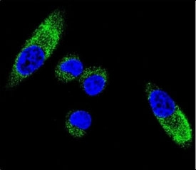 Confocal immunofluorescent analysis of CYP1A1 antibody with MDA-MB231 cells followed by Alexa Fluor 488-conjugated goat anti-rabbit lgG (green). DAPI was used as a nuclear counterstain (blue).