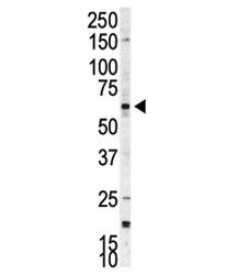 Western blot analysis of p70 S6 Kinase beta antibody and A375 cell lysate. Predicted molecular weight: 60-70 kDa