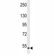 Western blot analysis of ZAK antibody and human HepG2 lysate. There are 3 isoforms of ZAK, visualized at ~91, 51 and 35 kDa.