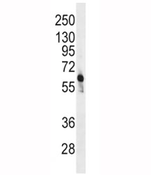 Western blot analysis of PFKFB3 antibody and CEM lysate