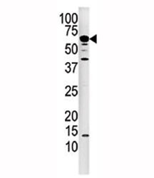 Western blot analysis of Calcineurin antibody and mouse kidney tissue lysate. Predicted molecular weight: ~62 kDa.