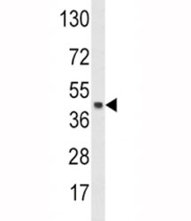 Western blot analysis of SKP2 antibody and HeLa lysate. Predicted molecular weight ~48 kDa