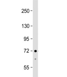 Western blot testing of human HepG2 cell lysate with ACSS3 antibody at 1:1000. Predicted molecular weight ~75 kDa.