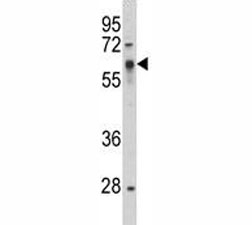 Western blot analysis of Src antibody and HepG2 lysate.  Predicted size 55~60 kDa