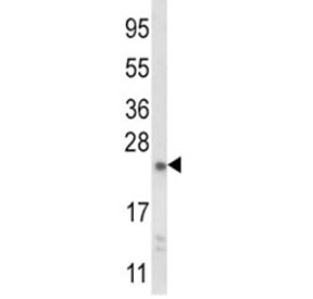 Western blot analysis of NQO2 antibody and mouse liver tissue lysate. Predicted molecular weight ~26 kDa.