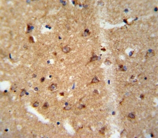IHC analysis of FFPE human brain tissue stained with GDNF antibody