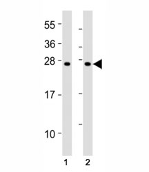 Western blot testing of SOCS1 antibody at 1:2000 dilution. Lane 1: mouse thymus lysate; 2: rat spleen lysate; Predicted molecular weight ~ 24 kDa.
