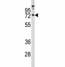 Western blot analysis of MAG antibody and A375 lysate