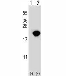 Western blot analysis of PIN1 antibody and 293 cell lysate either nontransfected (Lane 1) or transiently transfected (2) with the PIN1 gene. Expected molecular weight ~18kDa.
