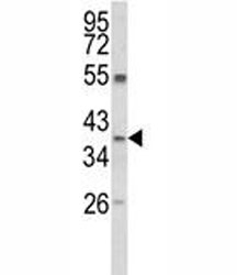 Western blot analysis of ARG1 antibody and MDA-MB231 lysate. Predicted molecular weight ~35kDa.