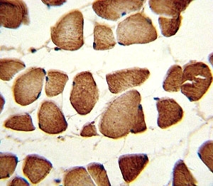 IHC analysis of FFPE human skeletal muscle stained with NAMPT antibody. Expected molecular weight ~56 kDa.