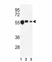 Western blot analysis of anti-beta Tubulin antibody and (1) CEM, (2) MCF-7, and (3) MDA-MB231 lysate.