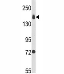 Western blot analysis of Integrin alpha 2 antibody and MDA-MB231 lysate