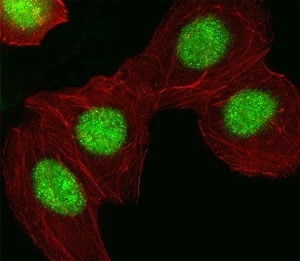 Fluorescent image of A549 cell stained with HMGA1 antibody at 1:25. HMGA1 immunoreactivity is localized to the nucleus.
