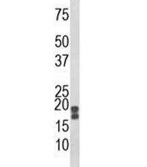 Western blot analysis of ACP1 antibody and human HeLa lysate. Predicted molecular weight 14-18 kDa (isoforms 1-3).