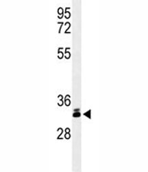 Western blot analysis of DKK-1 antibody and T47D lysate. Predicted molecular weight: 26-40 kDa depending on glycosylation level.