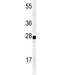 Western blot analysis of AANAT antibody and human Y79 lysate. Predicted molecular weight ~23 kDa.