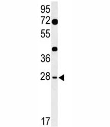 Western blot analysis of HES7 antibody and mouse heart tissue lysate.