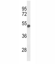 Western blot analysis of FOXG1 antibody and mouse brain tissue lysate. Predicted molecular weight: 50-52 kDa.